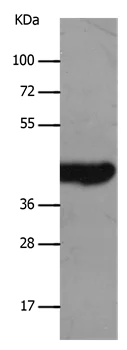 Western blot - Anti-MCT2 antibody - C-terminal (AB198272)