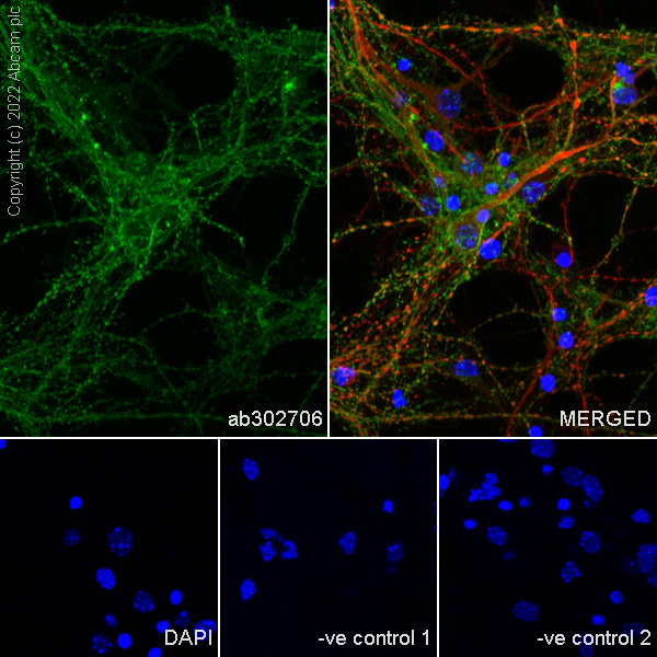Immunocytochemistry/ Immunofluorescence - Anti-MCT8 antibody [EPR26257-174] (ab302706), expandable thumbnail