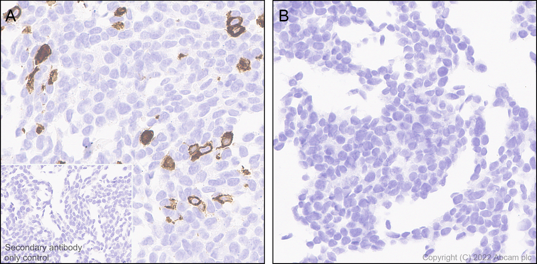 Immunohistochemistry (Formalin/PFA-fixed paraffin-embedded sections) - Anti-MCT8 antibody [EPR26257-174] (ab302706), expandable thumbnail