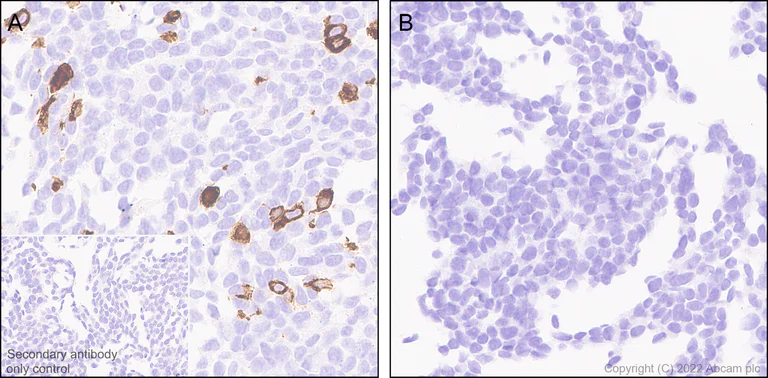 Immunohistochemistry (Formalin/PFA-fixed paraffin-embedded sections) - Anti-MCT8 antibody [EPR26257-174] (AB302706)