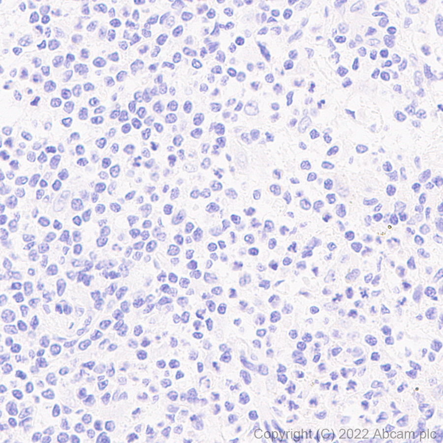 Immunohistochemistry (Formalin/PFA-fixed paraffin-embedded sections) - Anti-MCT8 antibody [EPR26257-174] (ab302706), expandable thumbnail