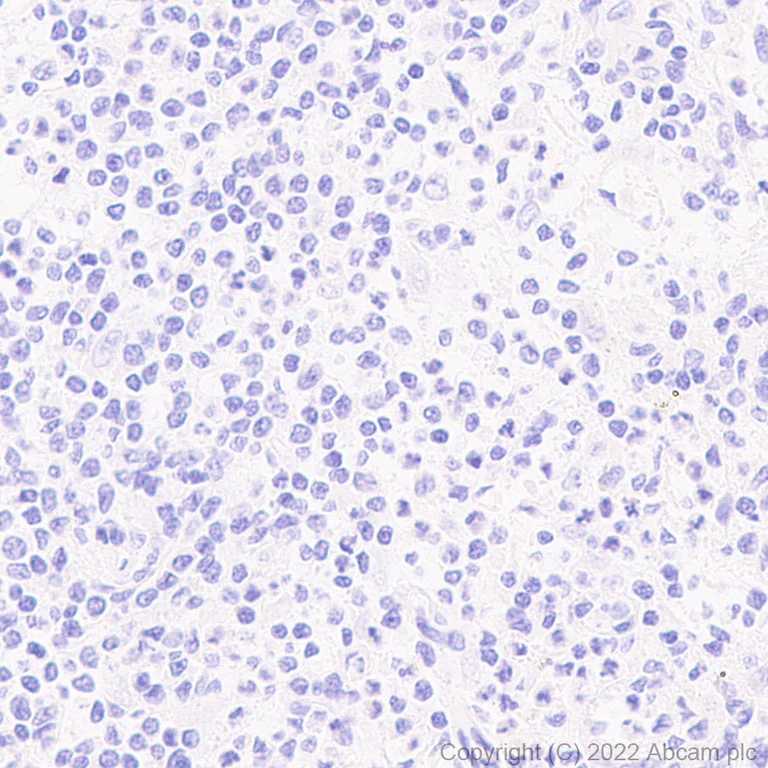 Immunohistochemistry (Formalin/PFA-fixed paraffin-embedded sections) - Anti-MCT8 antibody [EPR26257-174] (AB302706)