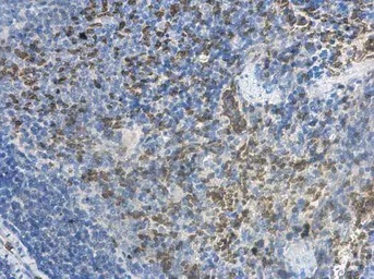 Immunohistochemistry (Formalin/PFA-fixed paraffin-embedded sections) - Anti-MCTS1/MCT-1 antibody (AB102678)