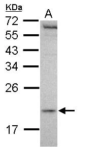 Western blot - Anti-MCTS1/MCT-1 antibody (AB102678)