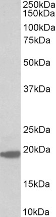 Western blot - Anti-MCTS1/MCT-1 antibody (AB156807)