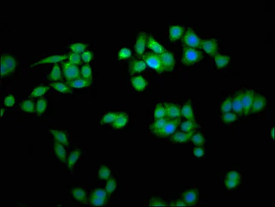 Immunocytochemistry/ Immunofluorescence - Anti-MCTS1/MCT-1 antibody (AB238825)