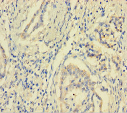 Immunohistochemistry (Formalin/PFA-fixed paraffin-embedded sections) - Anti-MCTS1/MCT-1 antibody (AB238825), expandable thumbnail