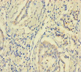 Immunohistochemistry (Formalin/PFA-fixed paraffin-embedded sections) - Anti-MCTS1/MCT-1 antibody (AB238825)