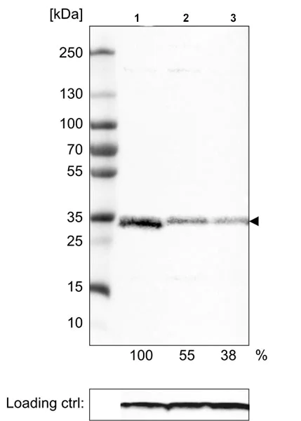 Western blot - Anti-MCU antibody [CL3576] (AB219827)