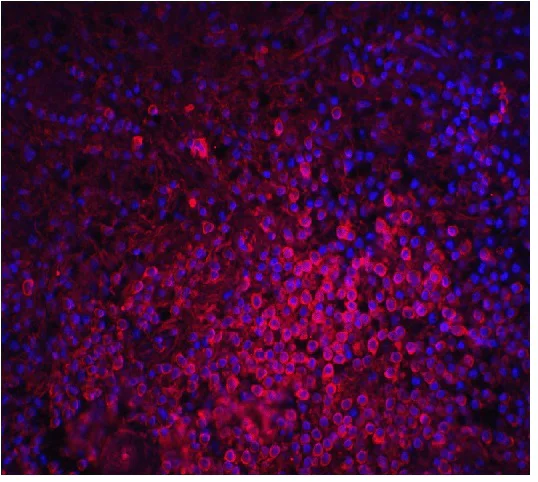 Immunocytochemistry/ Immunofluorescence - Anti-MD2 antibody (AB24182)
