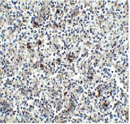 Immunohistochemistry (Formalin/PFA-fixed paraffin-embedded sections) - Anti-MD2 antibody (AB24182)