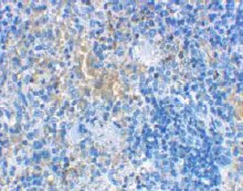 Immunohistochemistry (Formalin/PFA-fixed paraffin-embedded sections) - Anti-MD2 antibody (AB24182)