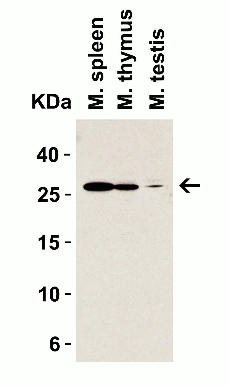 Western blot - Anti-MD2 antibody (AB24182)