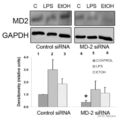 Western blot - Anti-MD2 antibody (AB24182)