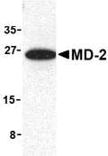 Western blot - Anti-MD2 antibody (AB24182)