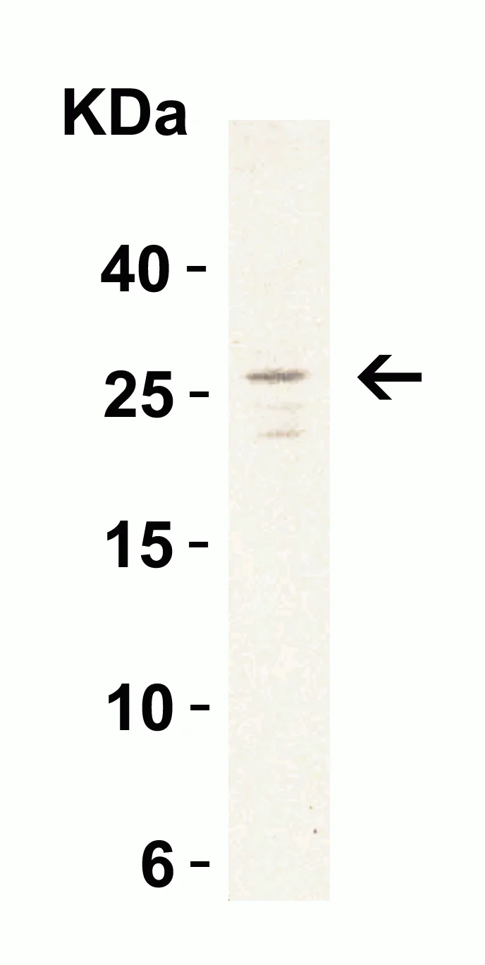 Western blot - Anti-MD2 antibody (AB24182)