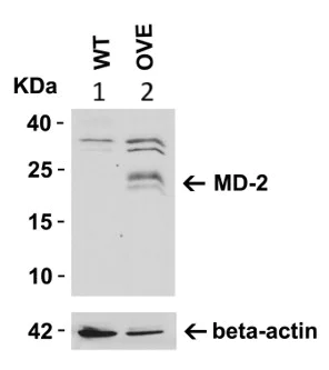 Western blot - Anti-MD2 antibody (AB24182)