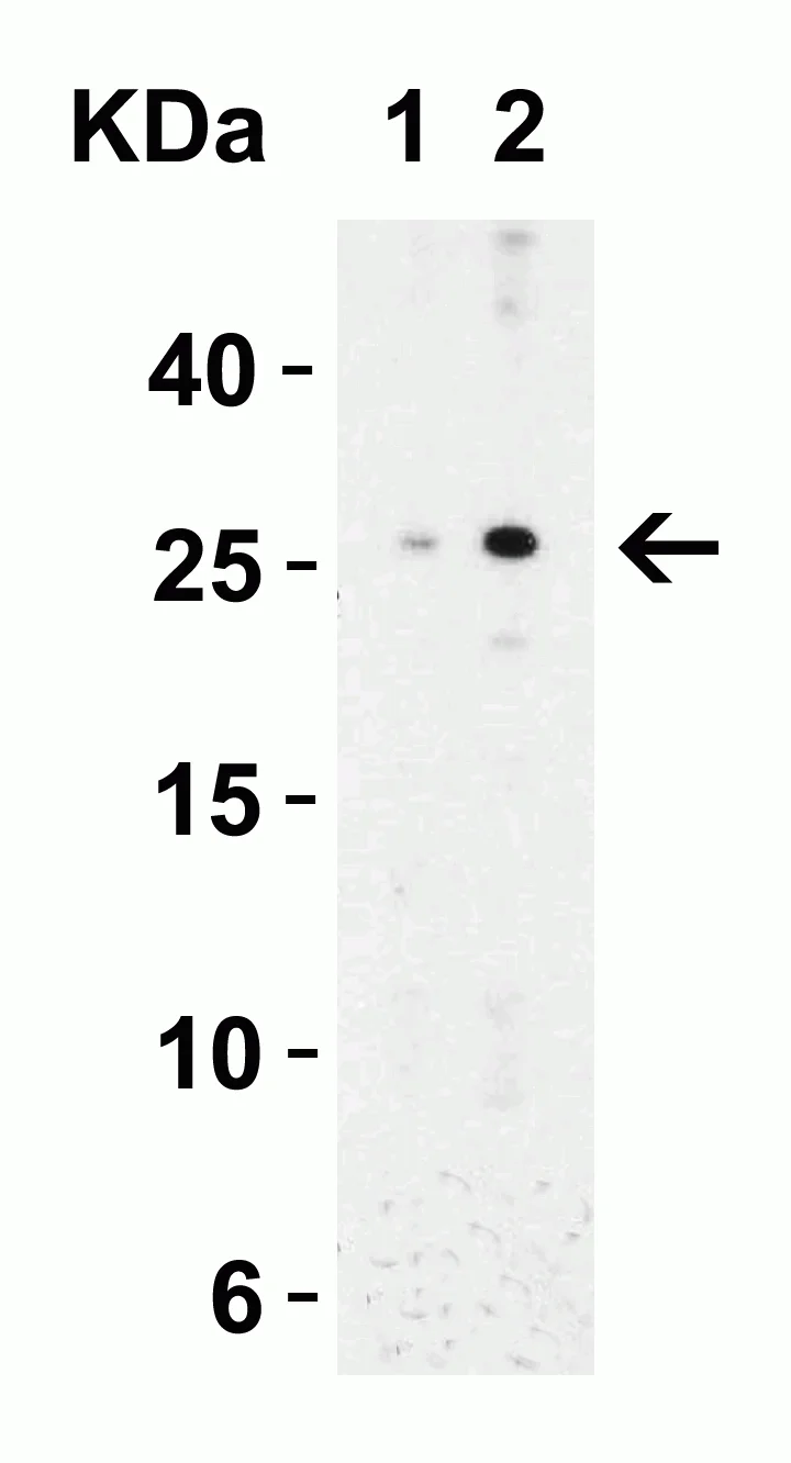 Western blot - Anti-MD2 antibody (AB24182)