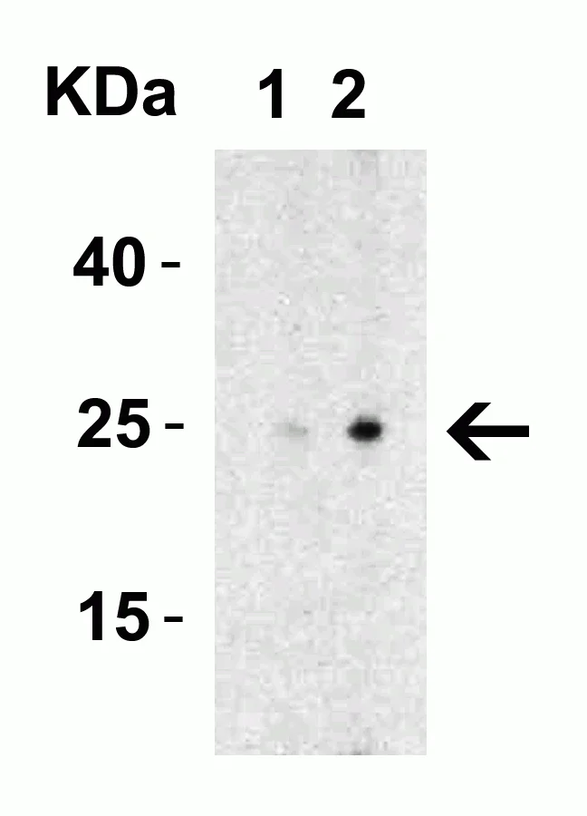Western blot - Anti-MD2 antibody (AB24182)