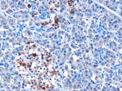 Immunohistochemistry (Formalin/PFA-fixed paraffin-embedded sections) - Anti-MDA5 antibody (AB4544)