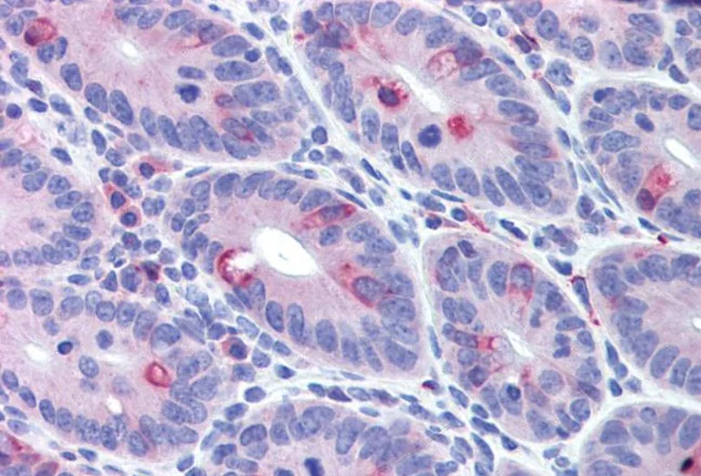 Immunohistochemistry (Formalin/PFA-fixed paraffin-embedded sections) - Anti-MDA5 antibody (AB79055)