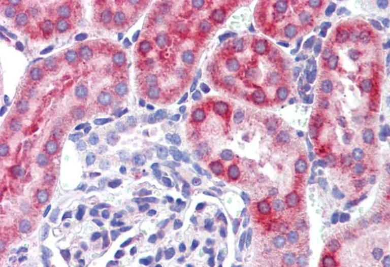Immunohistochemistry (Formalin/PFA-fixed paraffin-embedded sections) - Anti-MDA5 antibody (AB79055)