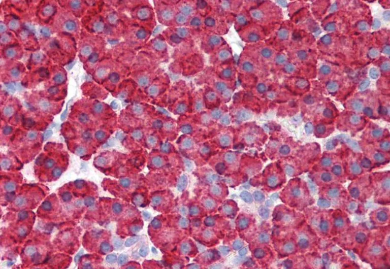 Immunohistochemistry (Formalin/PFA-fixed paraffin-embedded sections) - Anti-MDA5 antibody (AB79055)