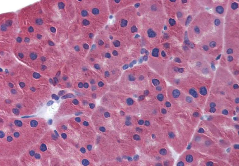 Immunohistochemistry (Formalin/PFA-fixed paraffin-embedded sections) - Anti-MDA5 antibody (AB79055)