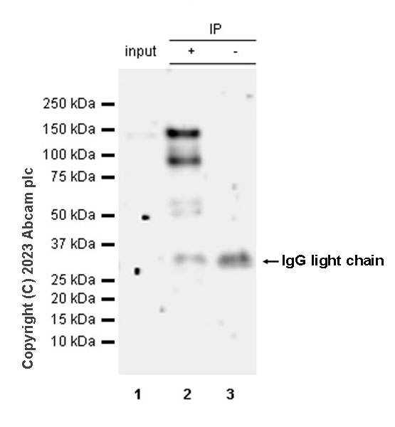 Immunoprecipitation - Anti-MDA5 antibody [EPR28350-21] - BSA and Azide free (ab315243), expandable thumbnail