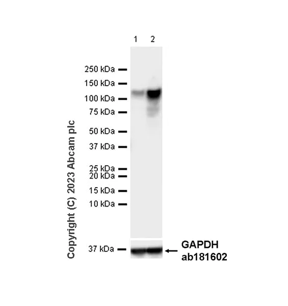 Western blot - Anti-MDA5 antibody [EPR28350-21] - BSA and Azide free (AB315243)