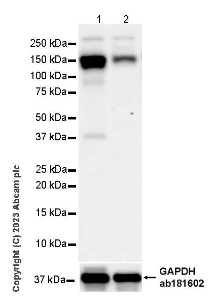 Western blot - Anti-MDA5 antibody [EPR28350-21] - BSA and Azide free (AB315243)