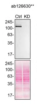 Western blot - Anti-MDA5 antibody [EPR6743] (AB126630)