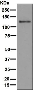 Western blot - Anti-MDA5 antibody [EPR6743] (AB126630)