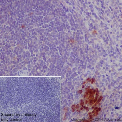 Immunohistochemistry (Formalin/PFA-fixed paraffin-embedded sections) - Anti-MDC antibody [EPR1362] (AB124768), expandable thumbnail