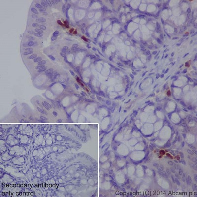 Immunohistochemistry (Formalin/PFA-fixed paraffin-embedded sections) - Anti-MDC antibody [EPR1362] (AB124768), expandable thumbnail