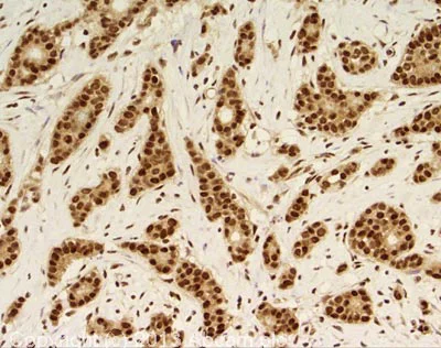 Immunohistochemistry (Formalin/PFA-fixed paraffin-embedded sections) - Anti-MDC1 antibody (AB11170)