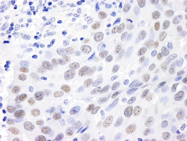 Immunohistochemistry (Formalin/PFA-fixed paraffin-embedded sections) - Anti-MDC1 antibody (AB11171)
