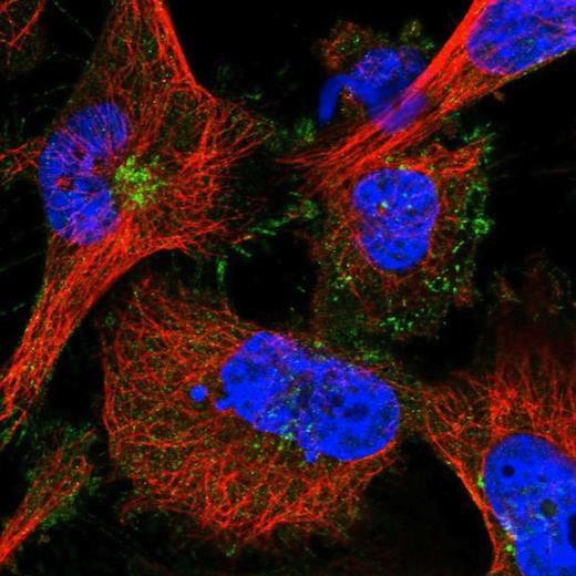 Immunocytochemistry/ Immunofluorescence - Anti-MDGA1 antibody (AB204180), expandable thumbnail