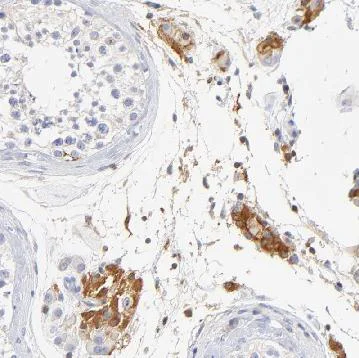 Immunohistochemistry (Formalin/PFA-fixed paraffin-embedded sections) - Anti-MDGA2 antibody (AB121164)