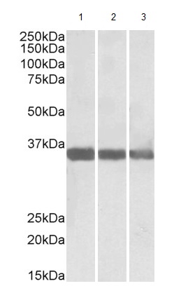 Western blot - Anti-MDH1 antibody (AB175455), expandable thumbnail