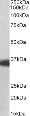 Western blot - Anti-MDH1 antibody (AB175455), expandable thumbnail