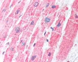 Immunohistochemistry (Formalin/PFA-fixed paraffin-embedded sections) - Anti-MDH1 antibody (AB78971)