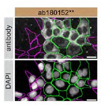 Immunocytochemistry/ Immunofluorescence - Anti-MDH1 antibody [EPR13597(B)] - C-terminal (AB180152)