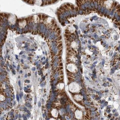 Immunohistochemistry (Formalin/PFA-fixed paraffin-embedded sections) - Anti-MDH2 antibody (AB262893)