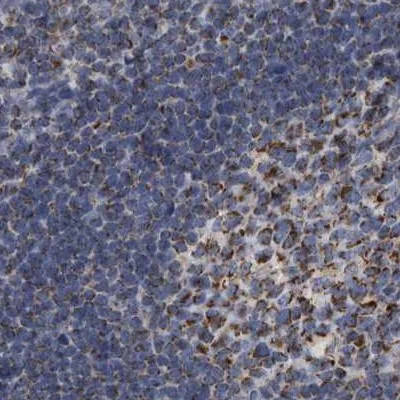 Immunohistochemistry (Formalin/PFA-fixed paraffin-embedded sections) - Anti-MDH2 antibody (AB262893)