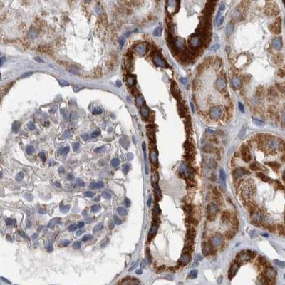 Immunohistochemistry (Formalin/PFA-fixed paraffin-embedded sections) - Anti-MDH2 antibody (AB262893)