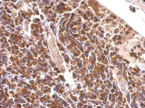 Immunohistochemistry (Formalin/PFA-fixed paraffin-embedded sections) - Anti-MDH2 antibody (AB96193)