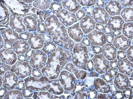 Immunohistochemistry (Formalin/PFA-fixed paraffin-embedded sections) - Anti-MDH2 antibody (AB96193)