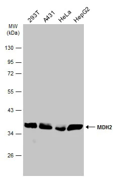 Western blot - Anti-MDH2 antibody (AB96193)