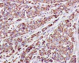 Immunohistochemistry (Formalin/PFA-fixed paraffin-embedded sections) - Anti-MDH2 antibody [EPR14882(B)] (AB181873)